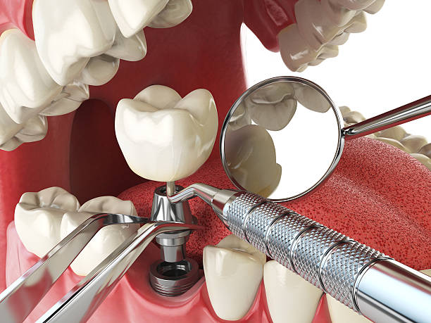 Best Urgent Tooth Repair  in Phillipsburg, KS